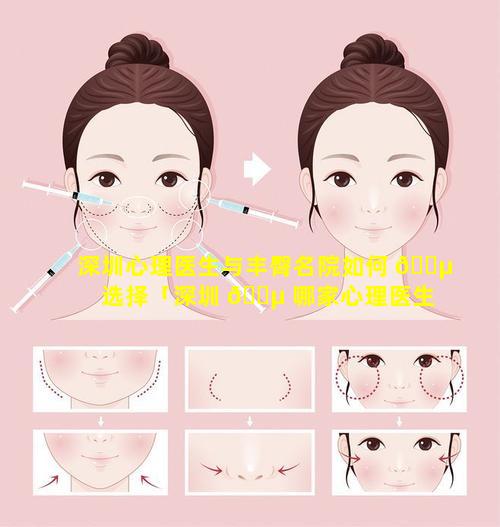 深圳心理医生与丰臀名院如何 🌵 选择「深圳 🐵 哪家心理医生比较正规」